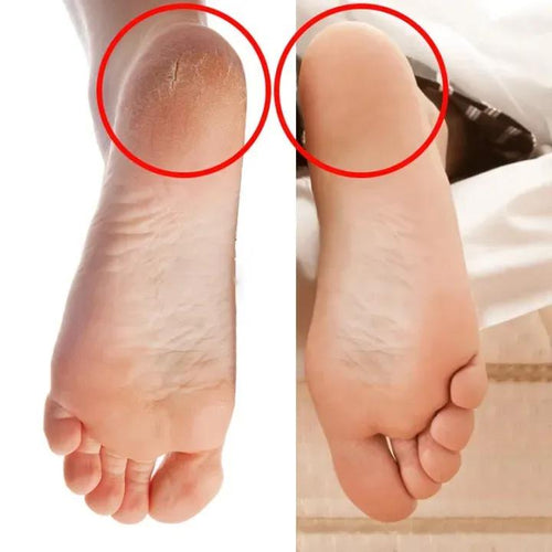 Silicone Heel Gel Socks